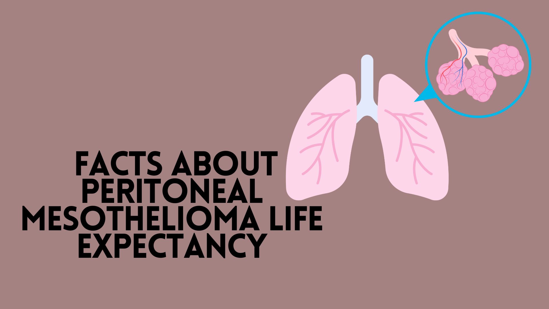 Facts About Peritoneal Mesothelioma Life Expectancy