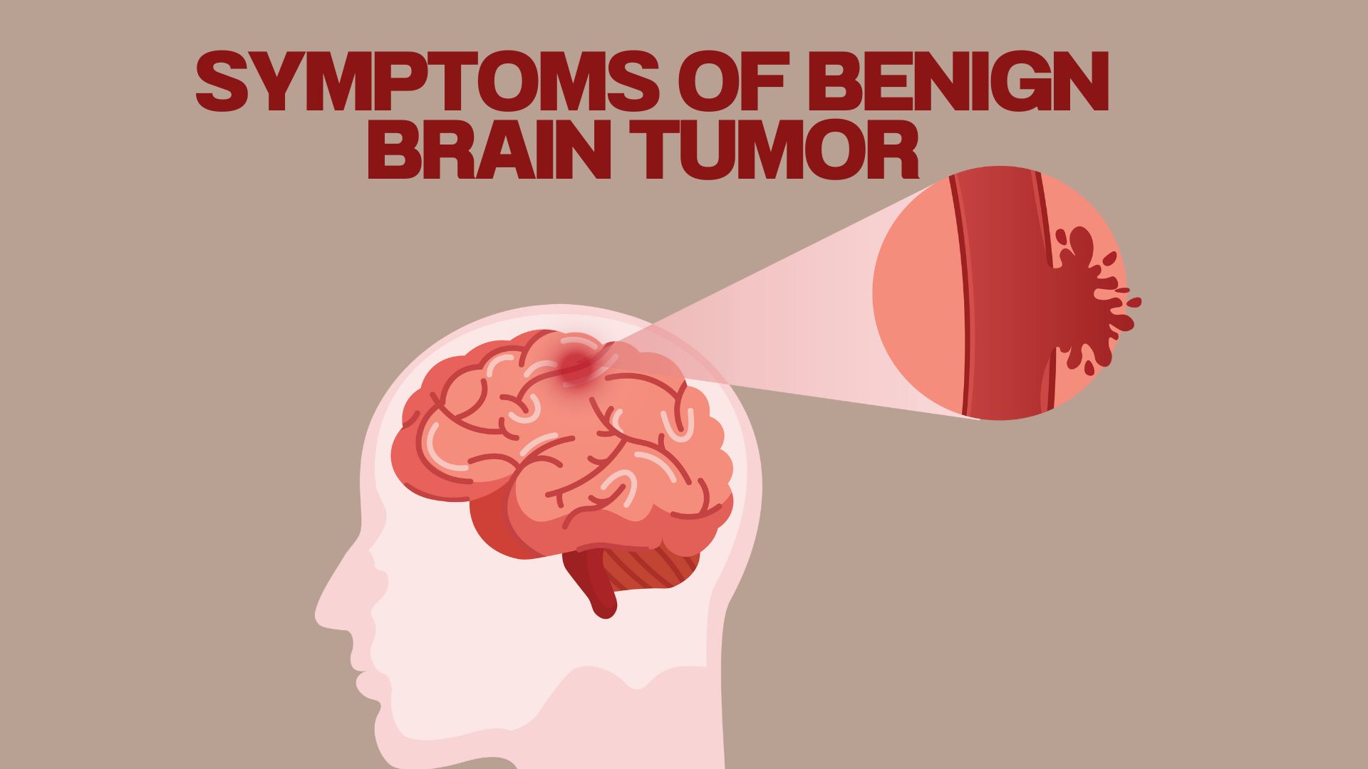Symptoms Of Benign Brain Tumor