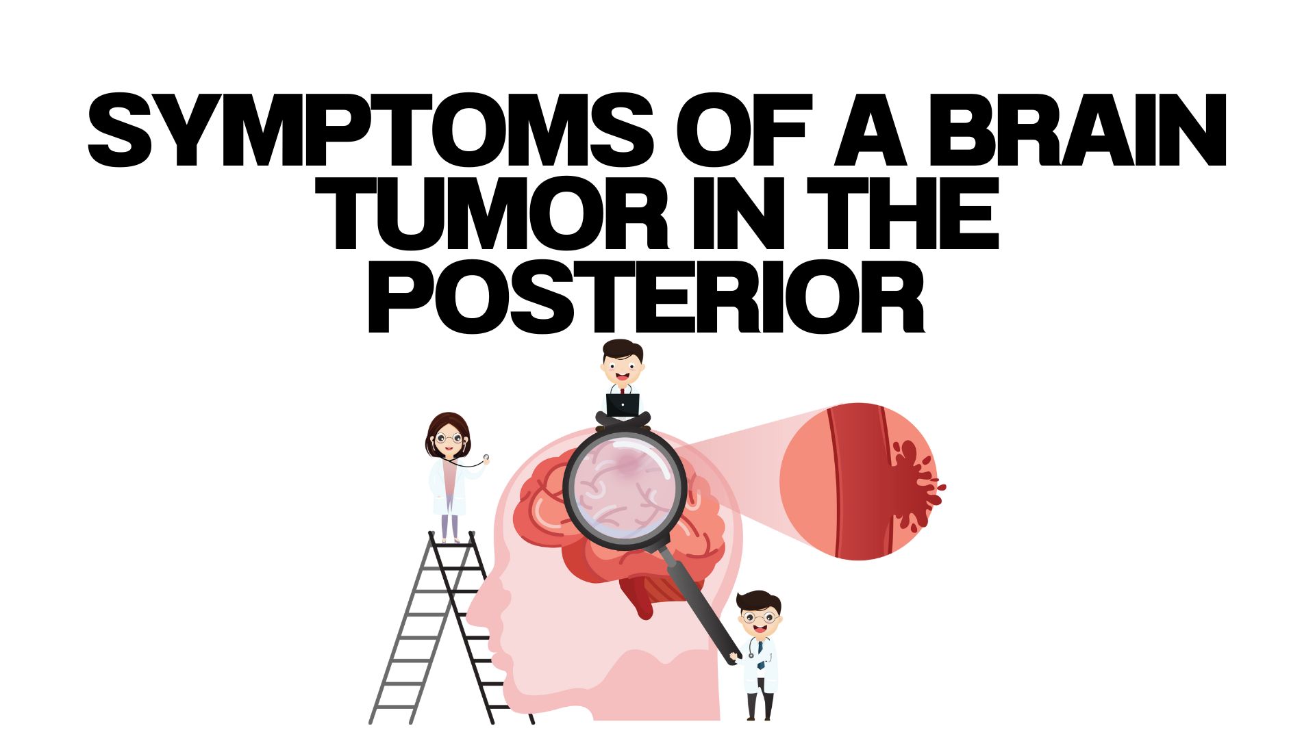 Symptoms of a Brain Tumor in the Posterior