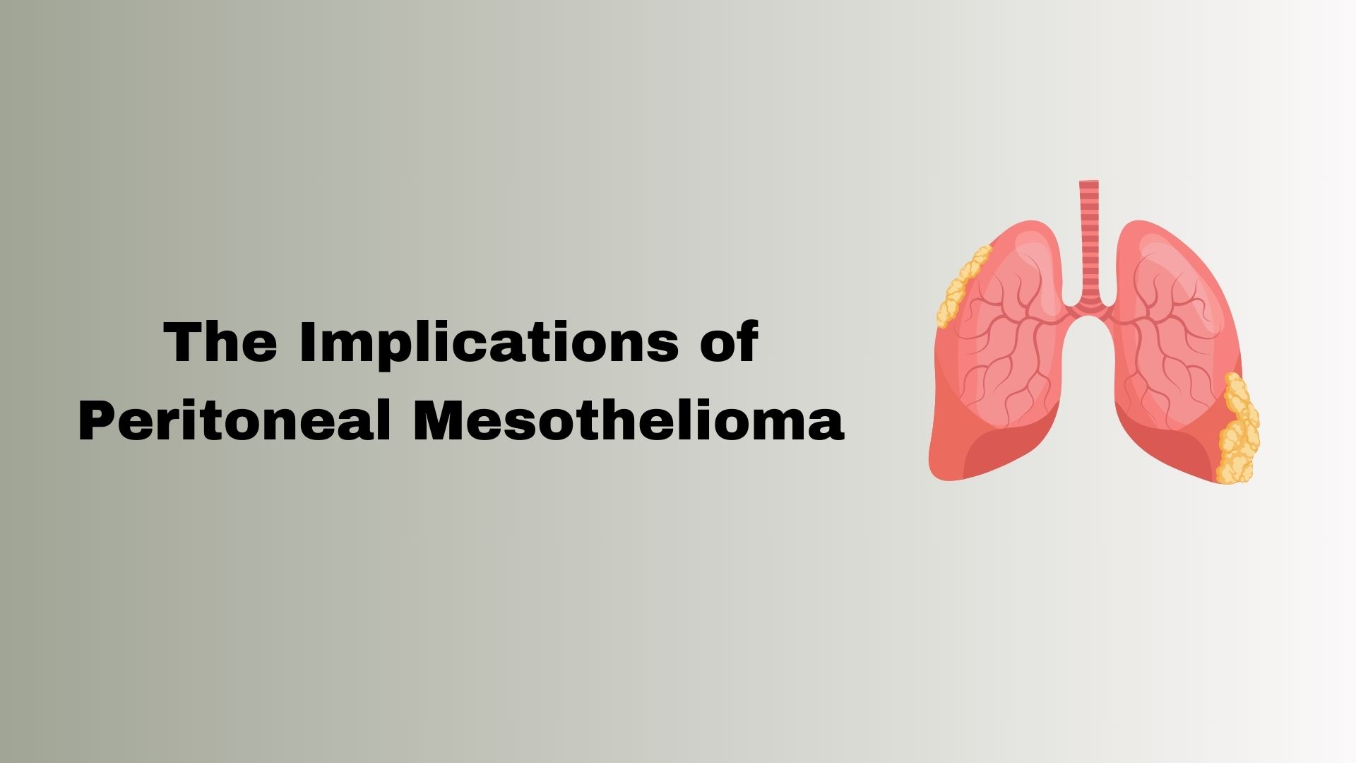 The Implications of Peritoneal Mesothelioma