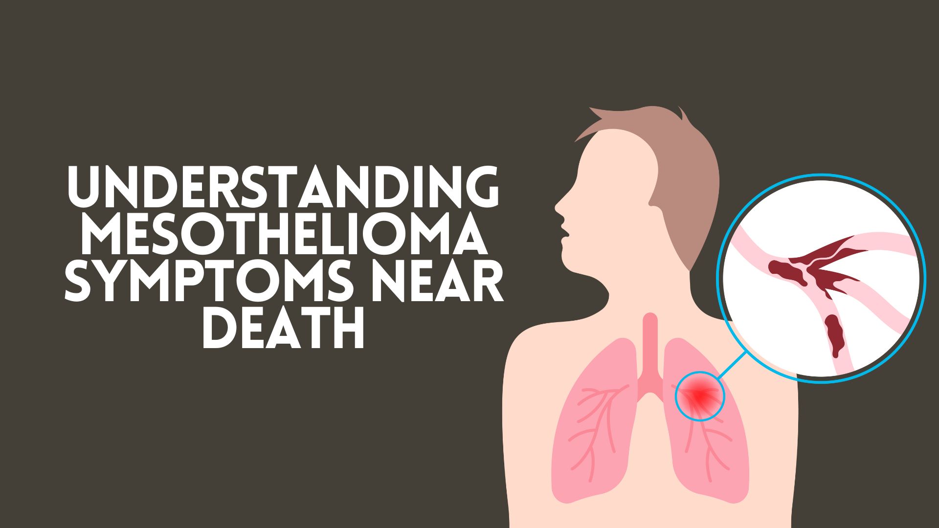 Understanding Mesothelioma Symptoms Near Death
