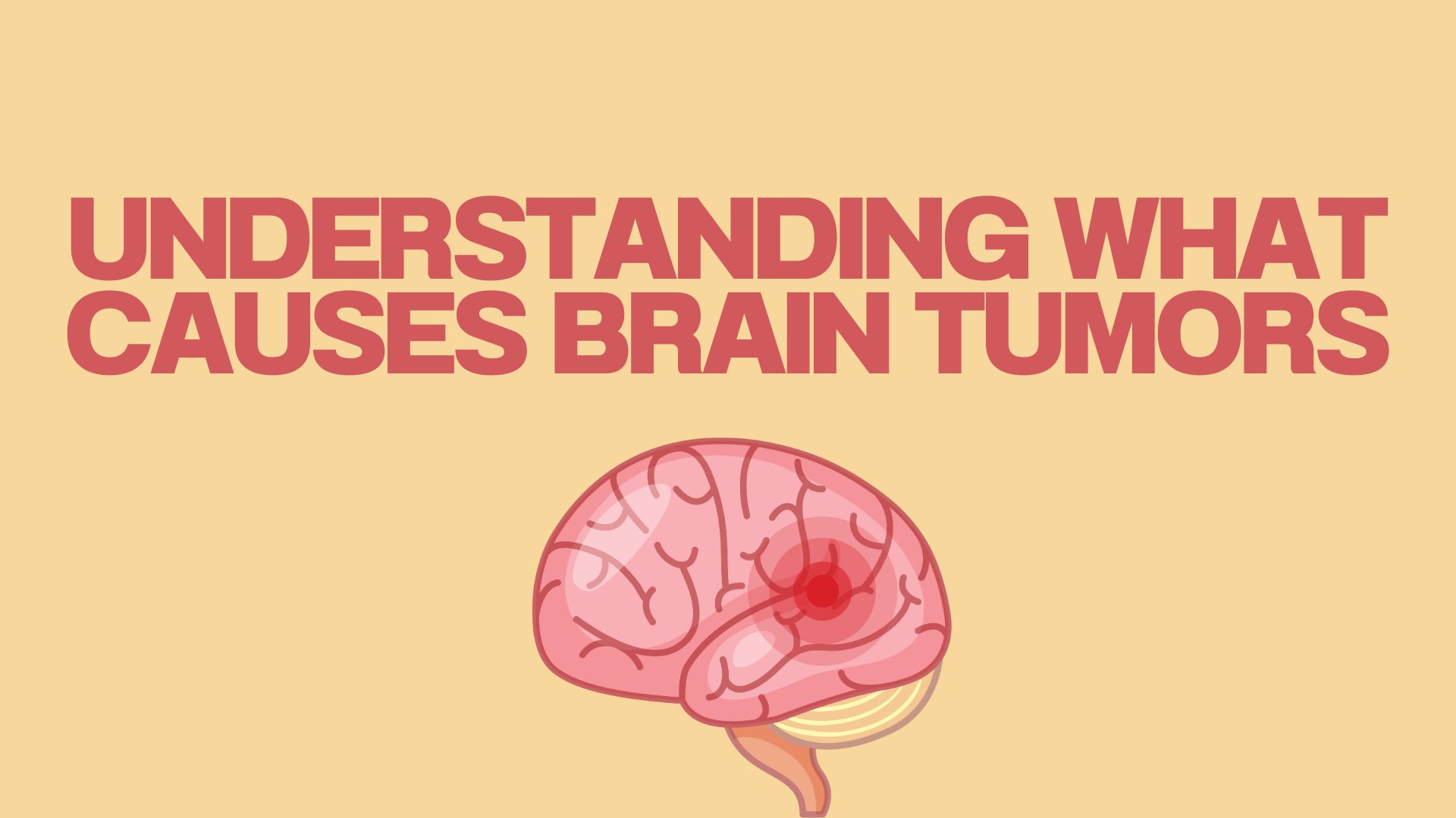 Understanding What Causes Brain Tumors
