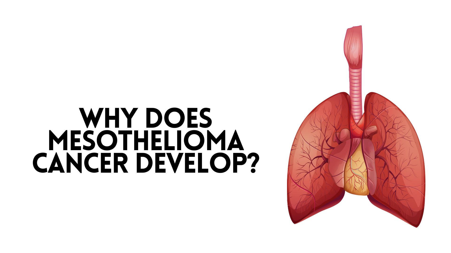 Why Does Mesothelioma Cancer Develop